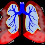 What Poor Sleep Habits Mean for Your Lung Health