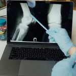 Bone Xray